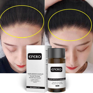 EFERO Hair Growth Essence Oil Hair Beard Growth Serum 20ML